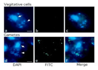 5MeC | 5-Methylcytosine (clone 5MC-CD) in the group Antibodies Plant/Algal / DNA/RNA/Cell Cycle / Plant Epigenetics/DNA methylation at Agrisera AB (Antibodies for research) (AS21 4559)